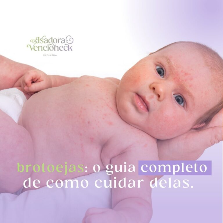 Brotoejas: o guia completo de como cuidar delas